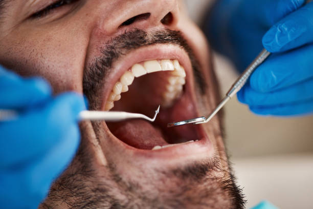 Best Emergency Treatment for Toothache in Canton, MS