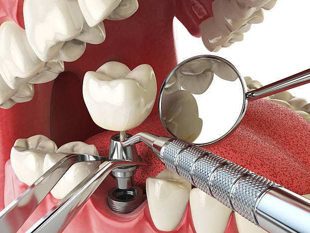 Best Walk-In Emergency Dentist in Canton, MS